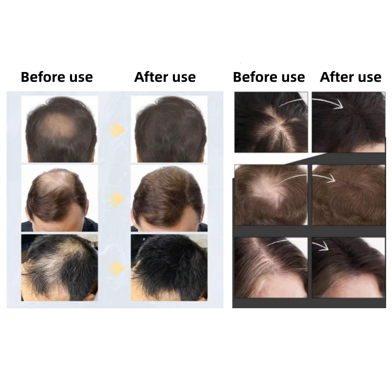 20 fibres capillaires en kérat - Hair Care Natural Products avis et prix