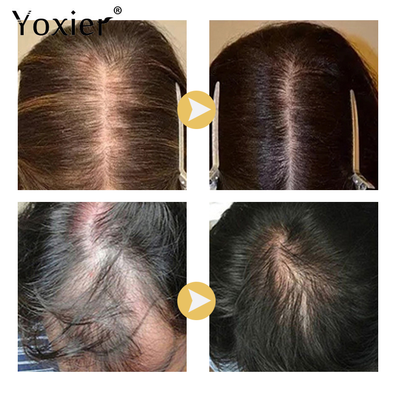 Sérum à croissance Intensive p - Hair Care Hair Serum avis et prix