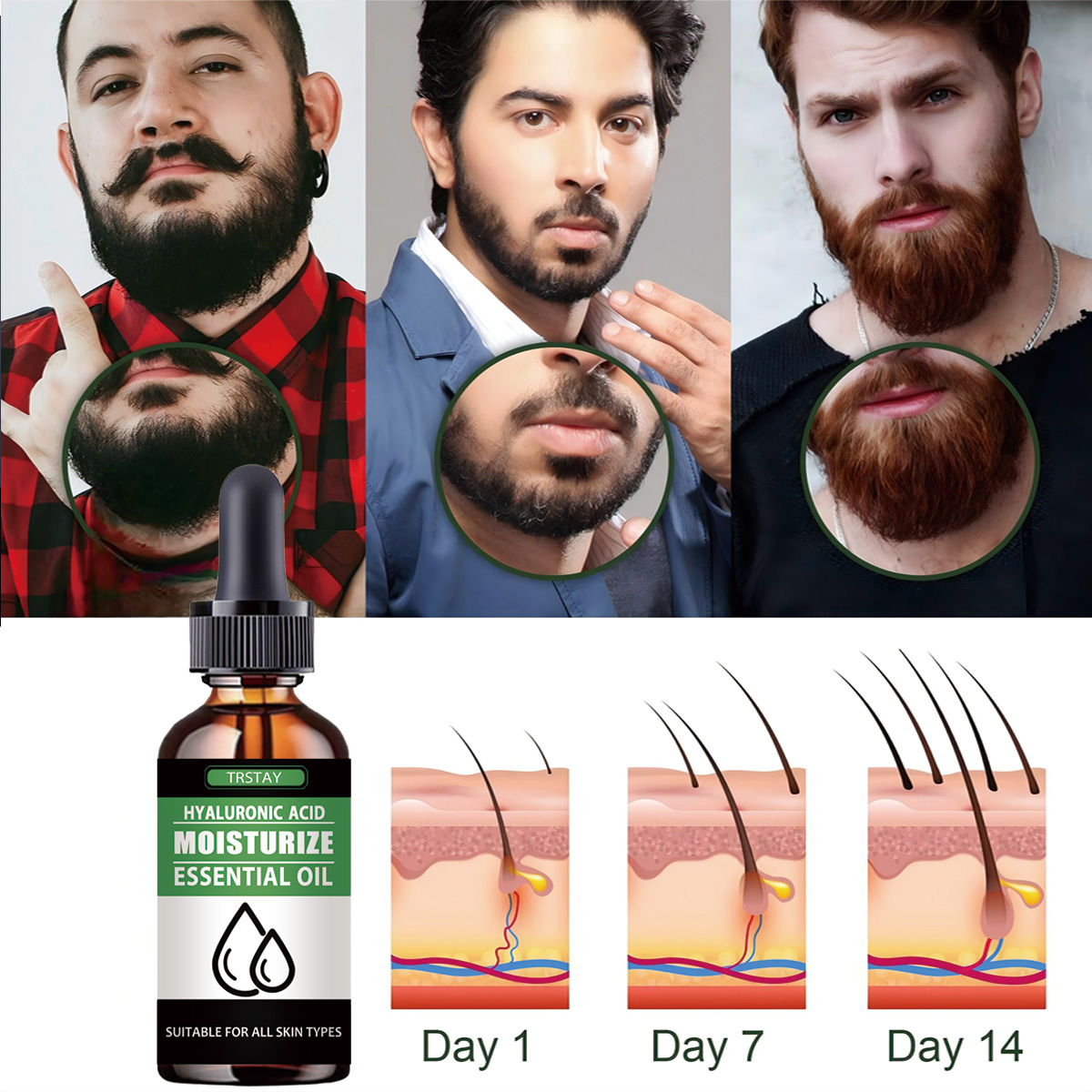 100% naturel accélérer les poi - Hair Care Natural Products avis et prix