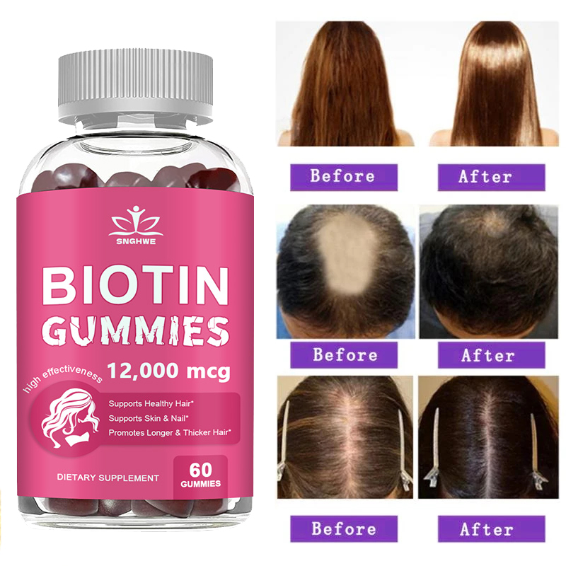 Gommes au collagène, gommes à  - Hair Care Gummies avis et prix