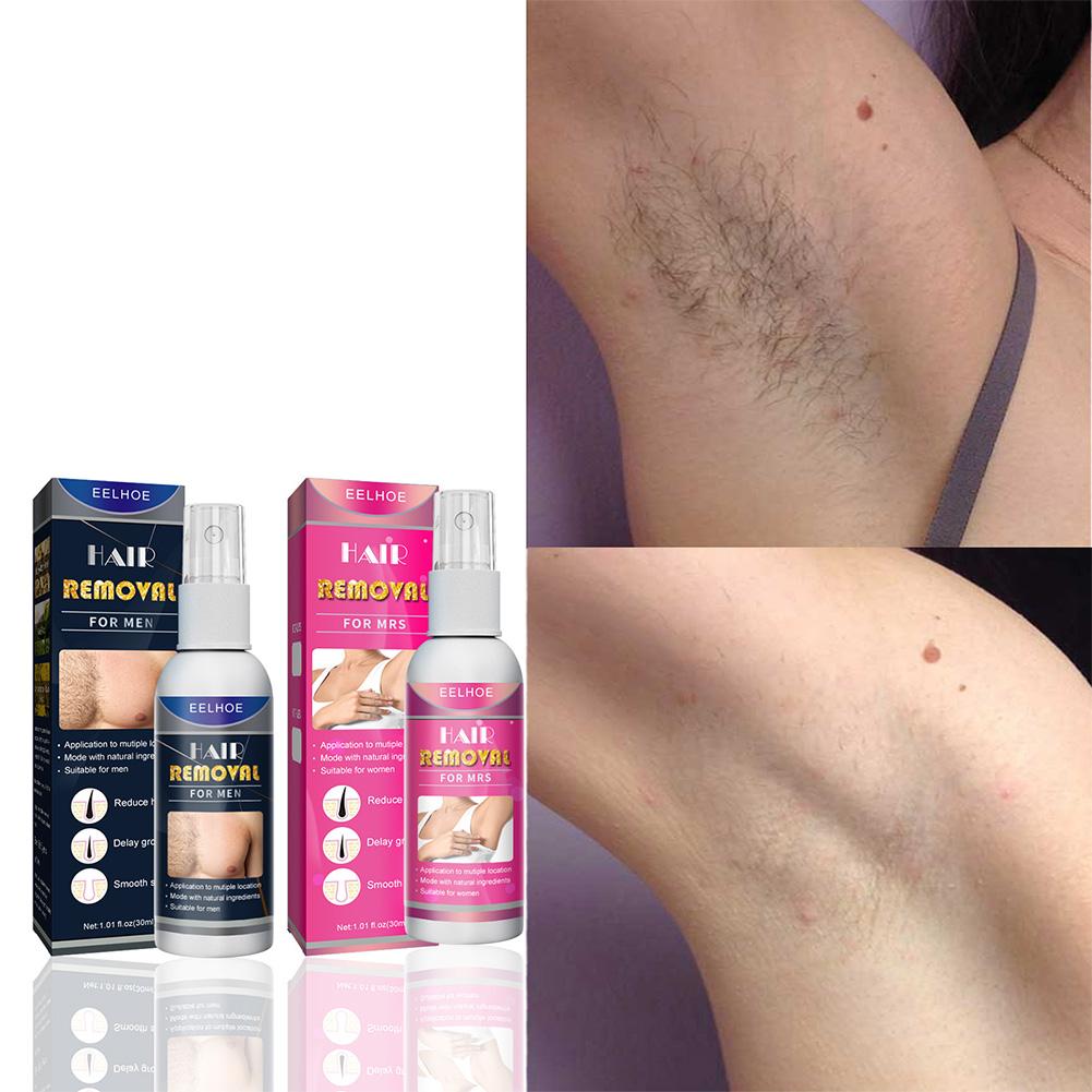 Épilateur Permanent indolore S - Hair Care Spray avis et prix